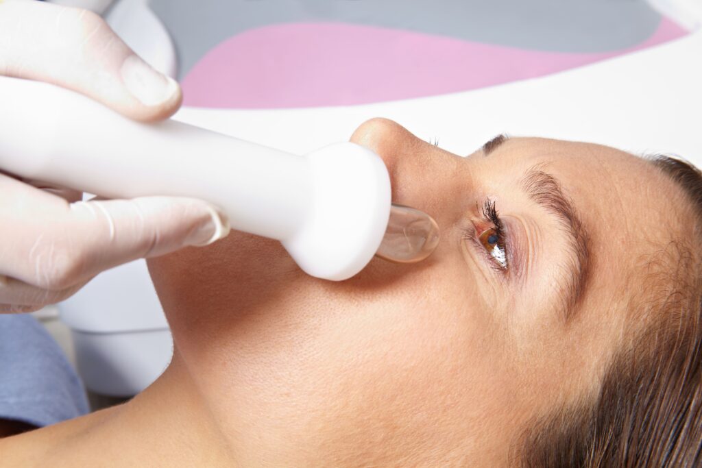 Options for Treating Dark Circles