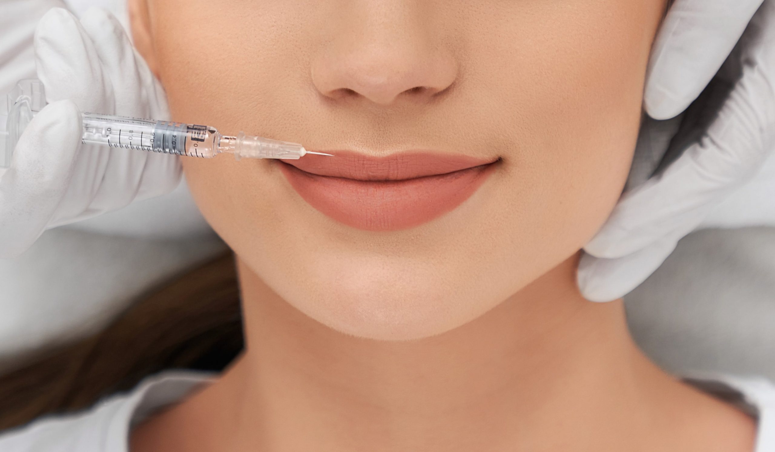 Upper Thin Lips Treatment & Lip Fillers in St. Paul, Edina