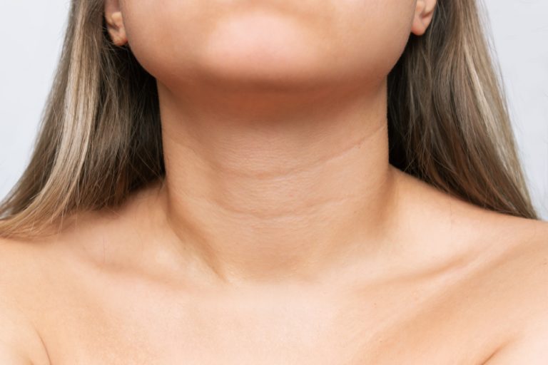 Neck lines
