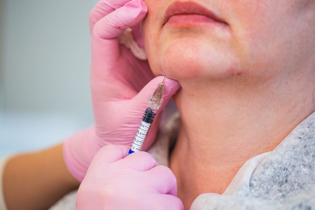 Treatment Options for Marionette Lines