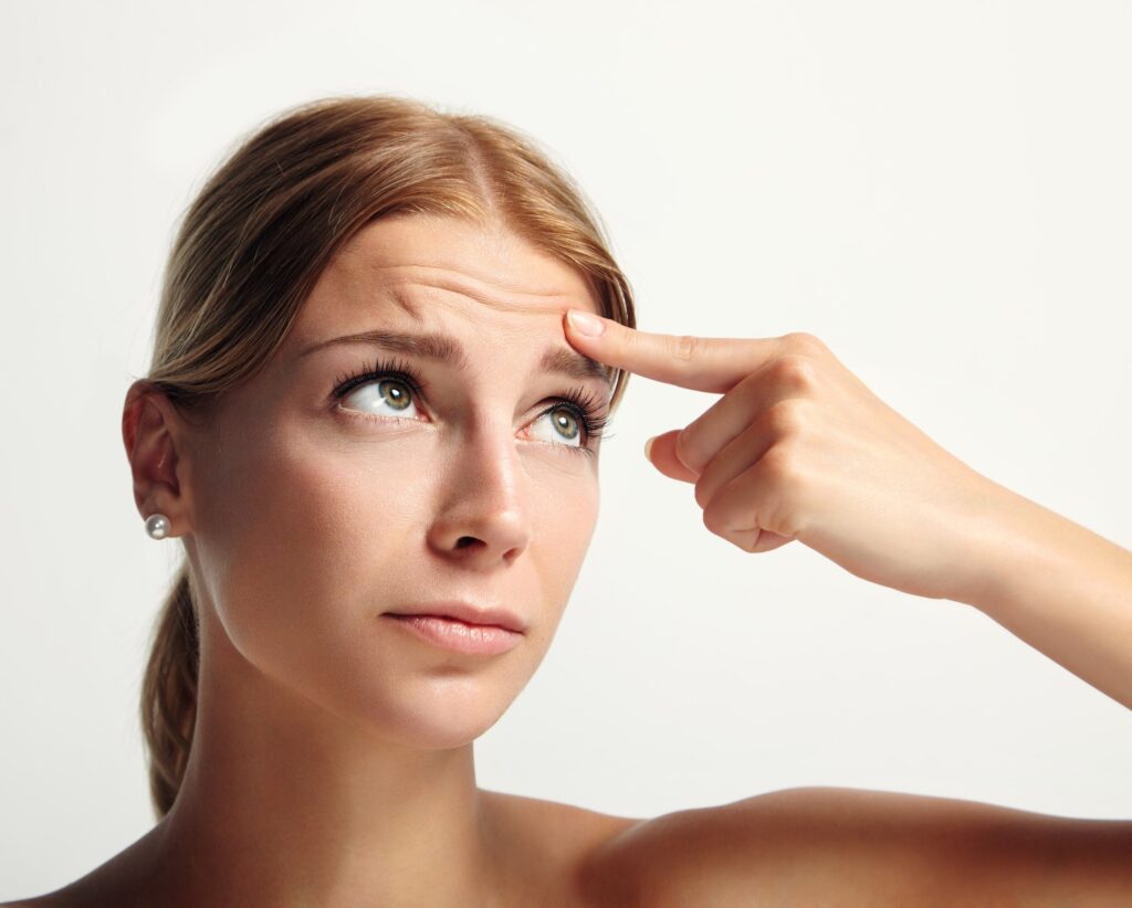 What Are Forehead Lines?