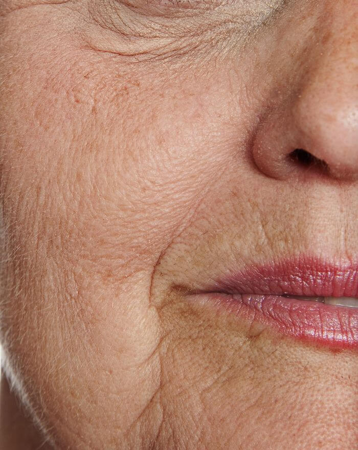 Old Women Lips
